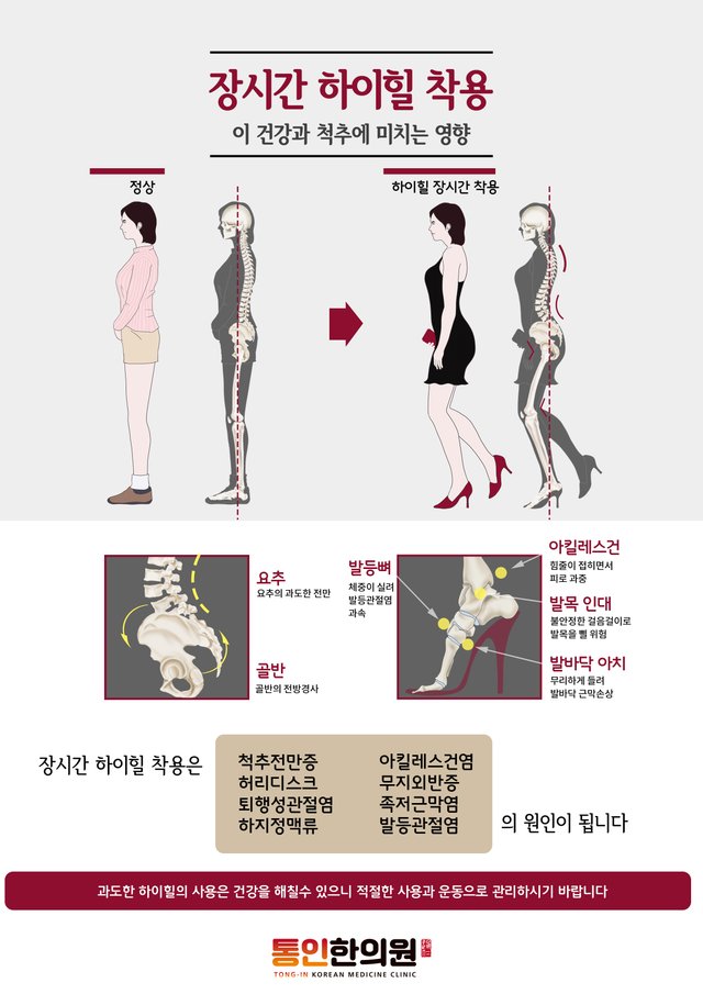 35[포스터]하이힐이 건강에 미치는 영향.jpg